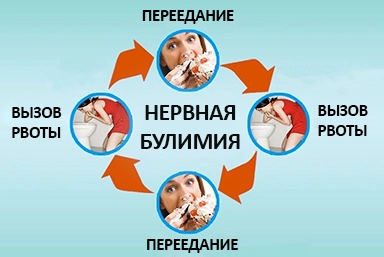 Лечение булимии в Сосновоборске